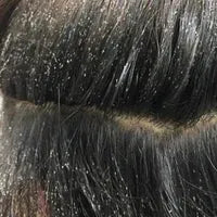Benefit image