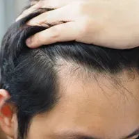 Benefit image