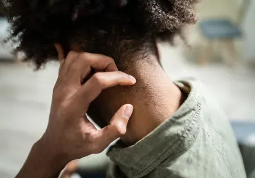 Persistent itching, especially around the neck and ears.