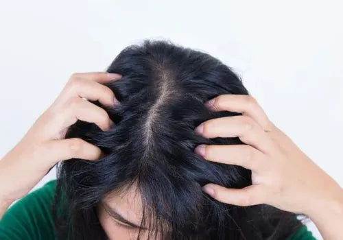 A sensation of something moving or crawling in the hair.